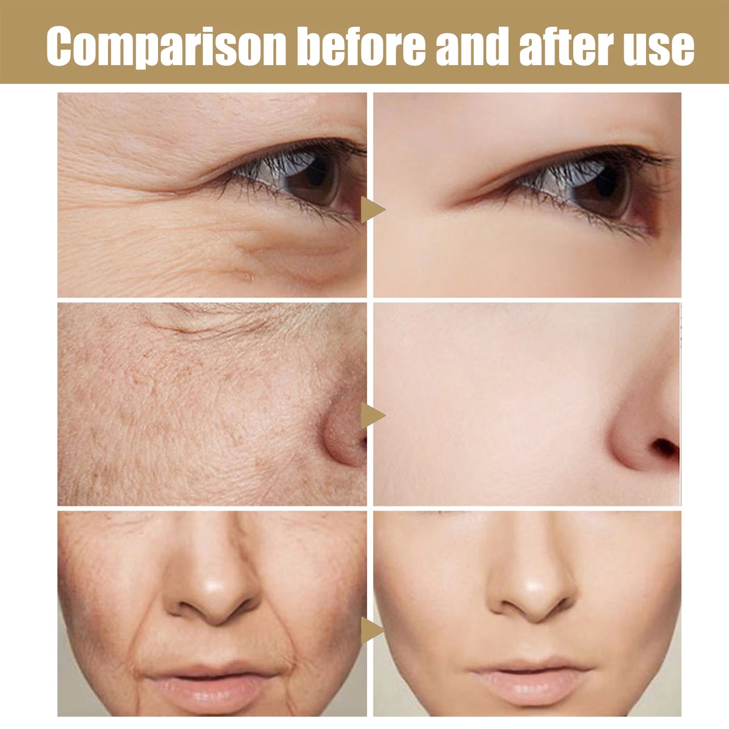Retinol Facial Essence – Nourishing, Moisturizing & Brightening Care