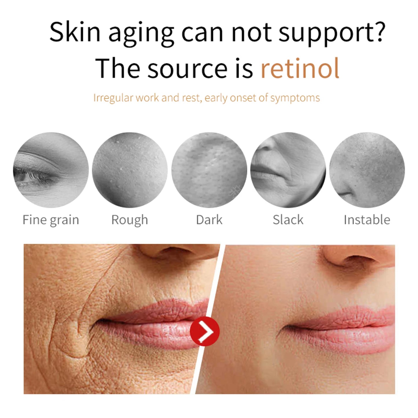 Retinol Face Cream 50ml – Moisturizing, Firming & Brightening with Hyaluronic Acid